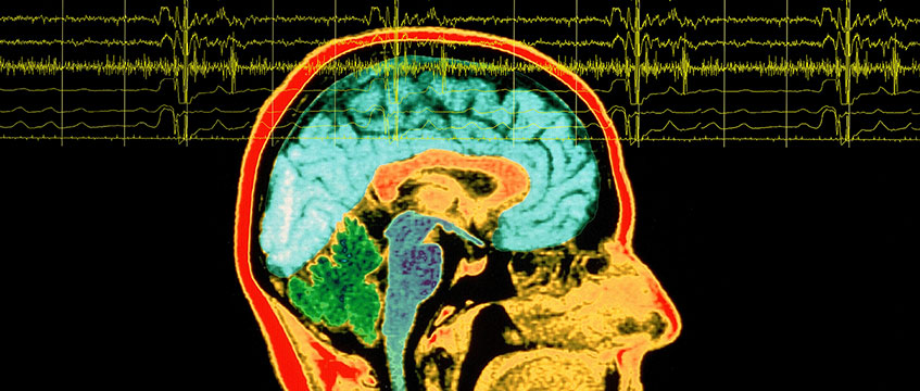 Why good leaders have cognitive diversity